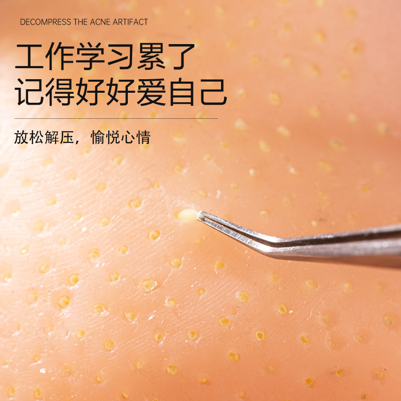 Stress relief, pimple squeeze, - Dolls ulasan dan harga